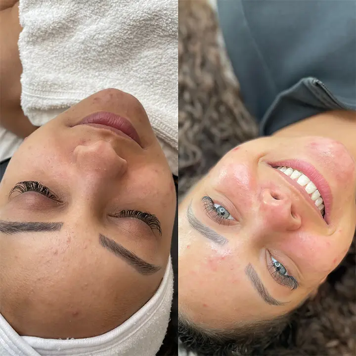 AnyConv.com__facial-glow-1